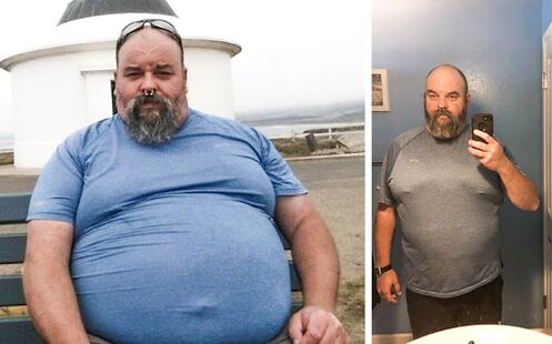 Foto vor und nach dem Keto Probiotix -Kurs, die Erfahrung, Kapseln mit einem Migter aus Venedig zu verwenden